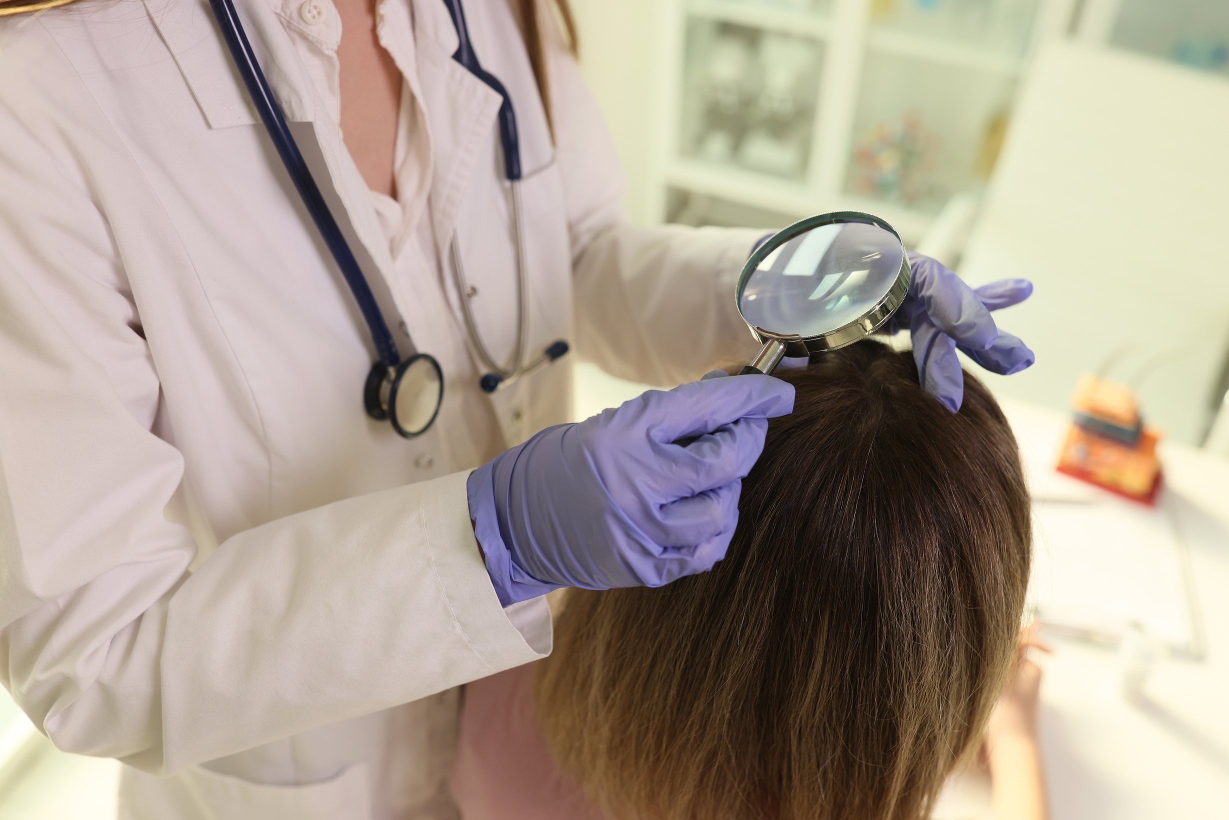 Trichologist Finds Out Cause of Hair Loss of Female Patient